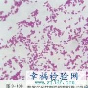 医院感染的重要病原菌介绍：鲍曼不动杆菌